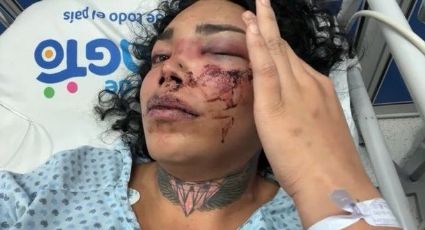 Paola Suárez aparece desde el hospital con el rostro desfigurado; su novio la golpeó