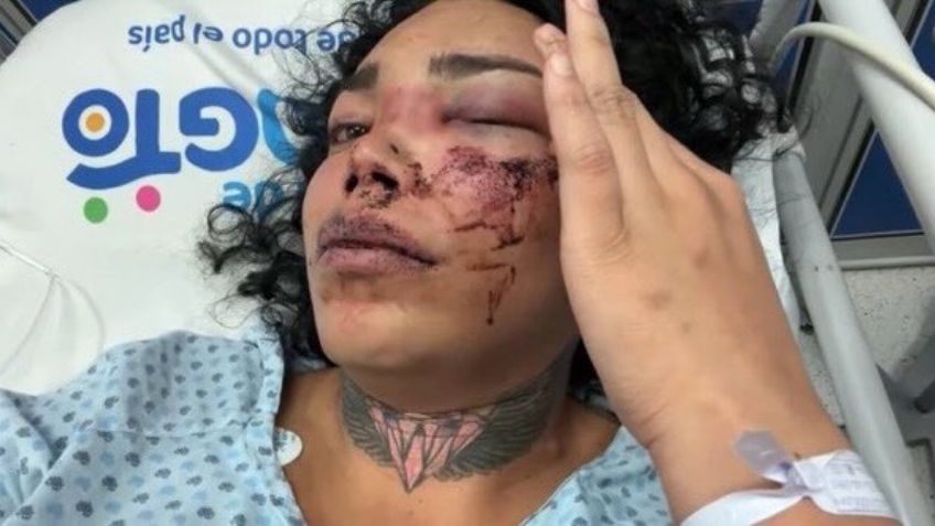 Paola Suárez aparece desde el hospital con el rostro desfigurado; su novio la golpeó