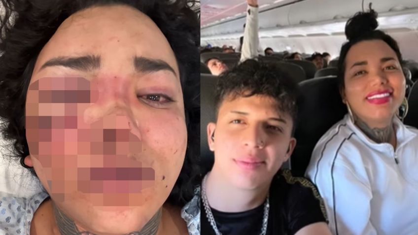 Novio de Paola Suárez lanza polémico mensaje para disculparse por golpiza: "Me equivoqué"