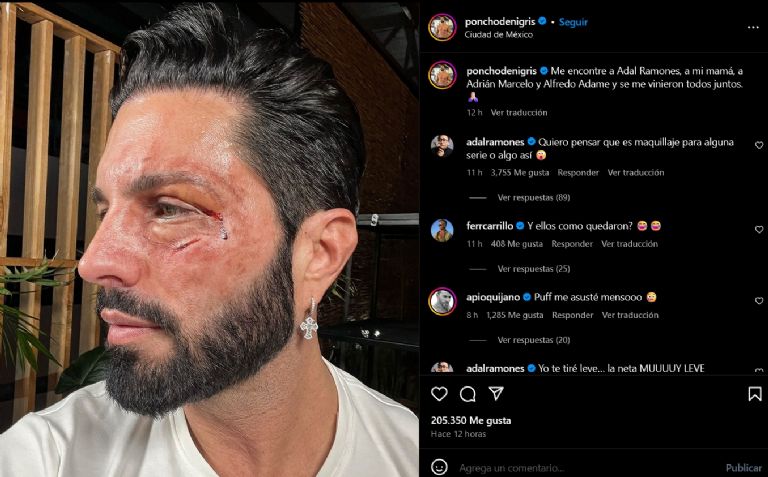 Poncho De Nigris revela golpiza y acusa a Adal Ramones