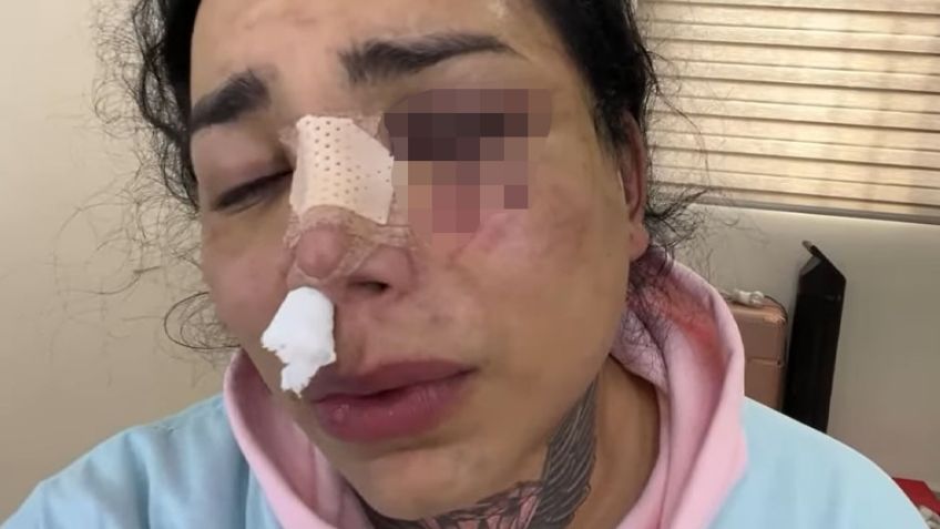 Ahogada en llanto, Paola Suárez hace dura confesión tras ataque de su ex: "Lo quiero mucho"