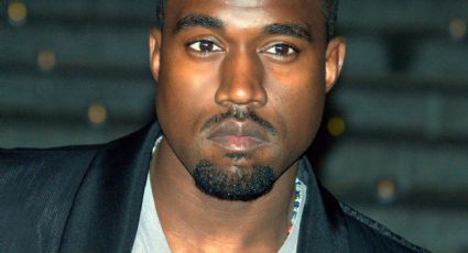 ¡Kanye West se queda sin dientes! El rapero los reemplazo por titanio