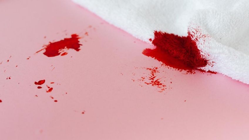 ¿Manchas de sangre en la ropa? Elimínalas de raíz con este ingrediente que ya tienes