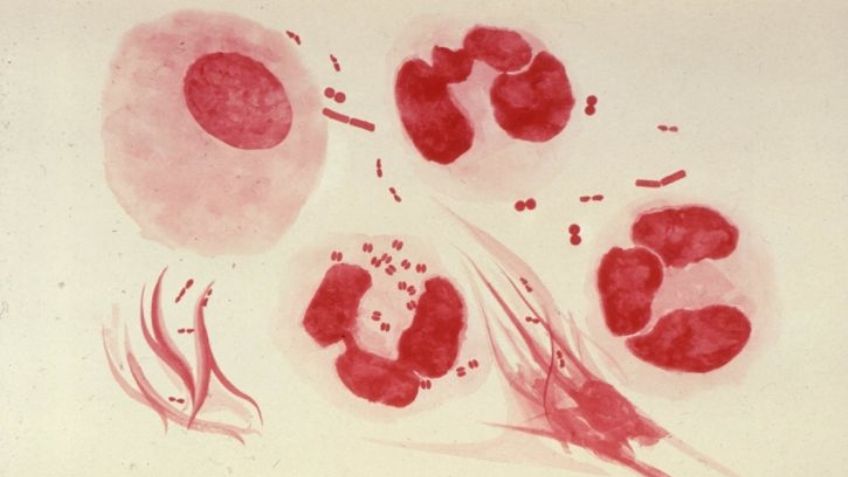 Preocupante repunte de enfermedades de transmisión sexual en México: Informe epidemiológico