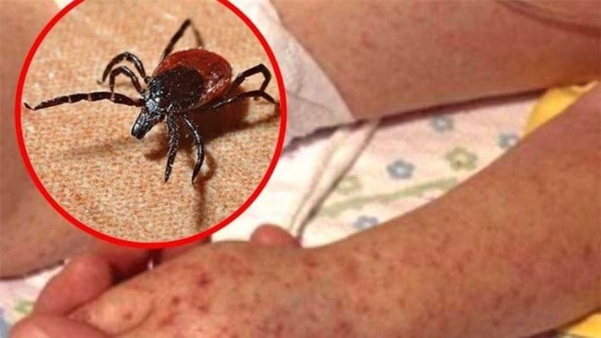 Navojoa registra su primer muerte por rickettsia del 2024