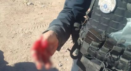 Policía Municipal de Guaymas es mordido por un indigente de San Carlos