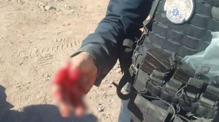 Policía Municipal de Guaymas es mordido por un indigente de San Carlos
