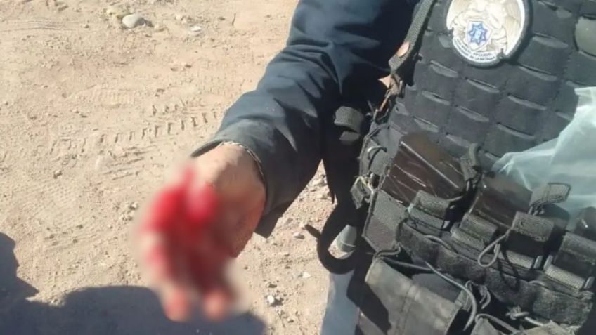 Policía Municipal de Guaymas es mordido por un indigente de San Carlos