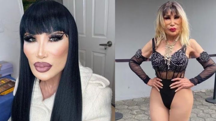 "Qué miedo": Con 71 años, actriz de Televisa se somete a cirugía y reaparece "desfigurada"