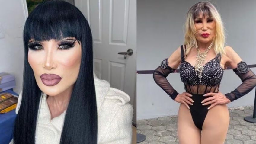 "Qué miedo": Con 71 años, actriz de Televisa se somete a cirugía y reaparece "desfigurada"