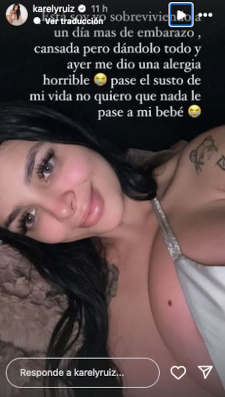 Karely Ruiz sufre de alergía en pleno embarazo