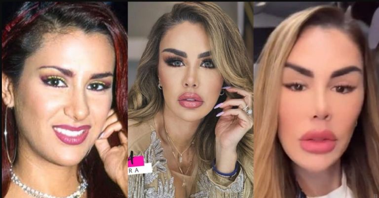 Antes y después de las cirugías plásticas