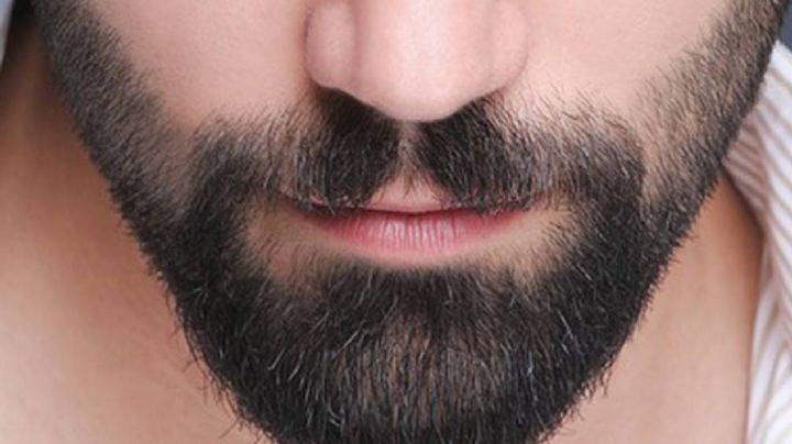 Francia: Se hace un injerto de barba y termina con graves secuelas; decide acabar con su vida