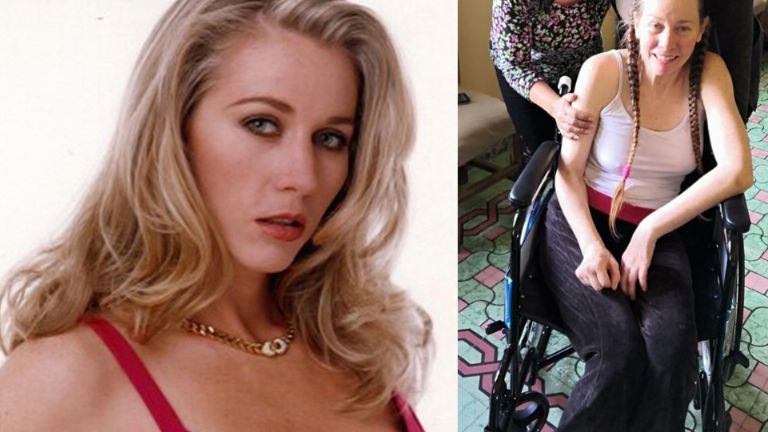 Antes y después de la actriz Mónica Dossetti