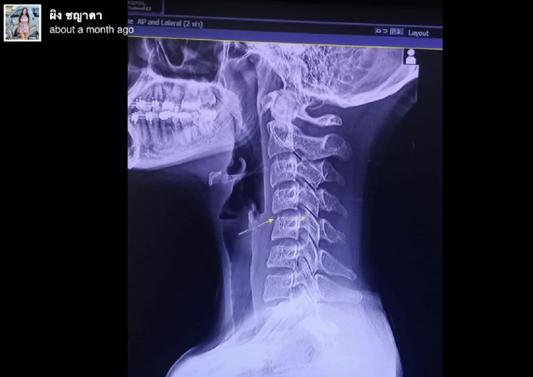 Radiografía de la cantante