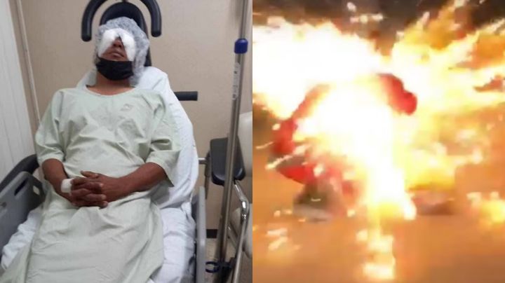 Disfrazado de Santa Claus, Miguel pierde un ojo en explosión de pirotecnia, en Coahuila