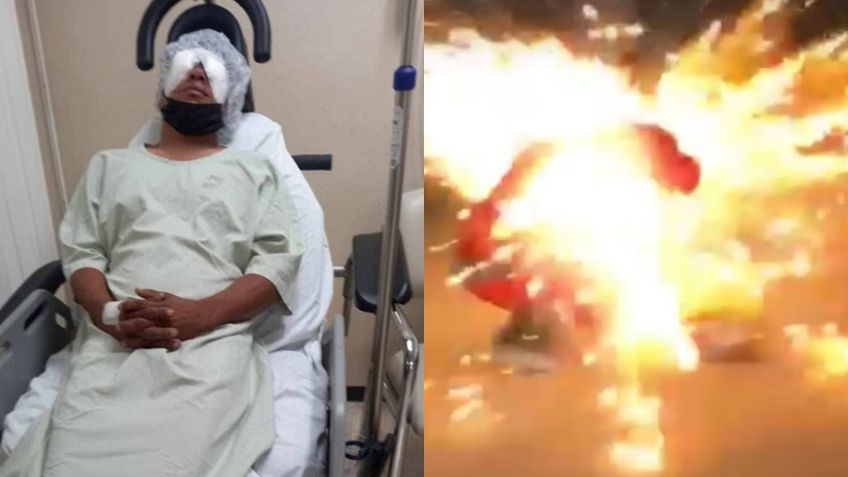 Disfrazado de Santa Claus, Miguel pierde un ojo en explosión de pirotecnia, en Coahuila