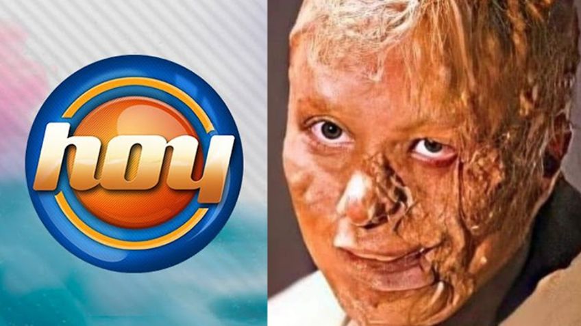 Acabó desfigurada: Tras retiro de Televisa y un divorcio, actriz vuelve a 'Hoy' y da noticia