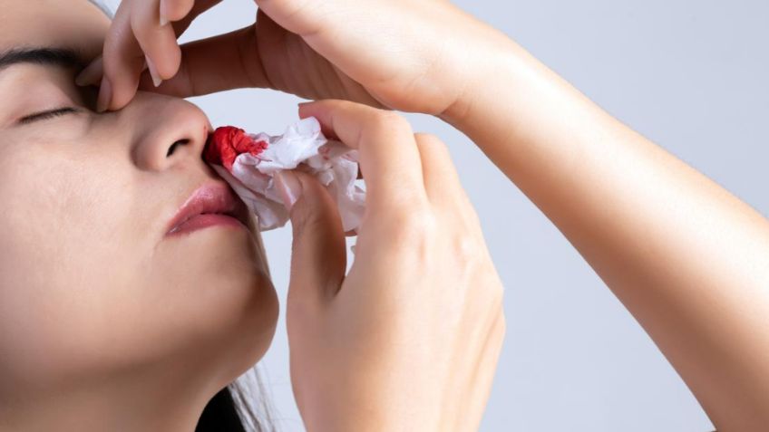 ¡Evita esta peligrosa postura! No inclines la cabeza hacia atrás durante una hemorragia nasal