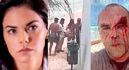 Livia Brito pierde demanda de paparazzi al que golpeó; Ernesto Zepeda habla de la sentencia