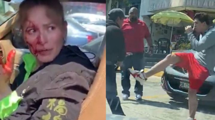 Mujer brutalmente golpeada por Fofo Márquez rompe el silencio tras ser vinculado a proceso