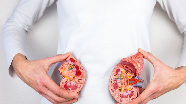 Cálculos renales: 4 bebidas que tienes que tomar para evitar la formación de cristales