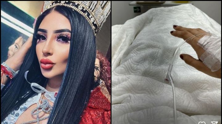 Bellakath causa alerta al compartir inquietantes FOTOS, ¿destapa problemas de salud?