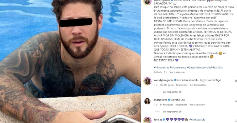 Laura Vignatti exhibe fotos de la brutal golpiza que recibió y denuncia a su novio