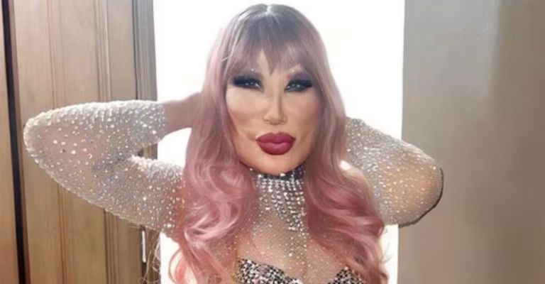 Lyn May revela el desgarrador momento en que se desfiguró el rostro y sus consecuencias