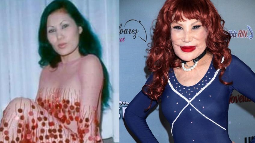 Se desfiguró el rostro: Tras dejar Televisa, querida actriz reaparece con trágica confesión