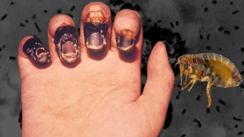 Nuevo caso de peste bubónica confirmado en Colorado, EU ¿Cuáles son los síntomas?