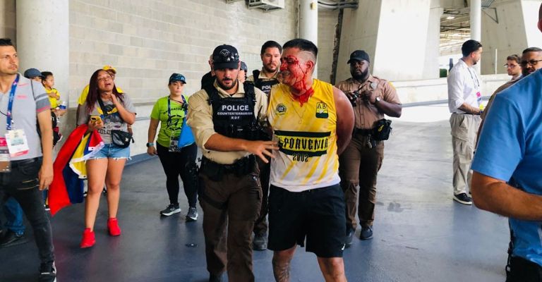 Un fan colombiano es detenido por la policía