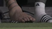 Foto ilustrativa de la nota titulada Así quedó el tobillo de Lionel Messi tras su escalofriante lesión en la Copa América