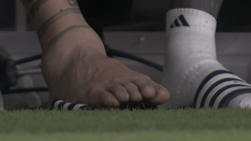 Así quedó el tobillo de Lionel Messi tras su escalofriante lesión en la Copa América