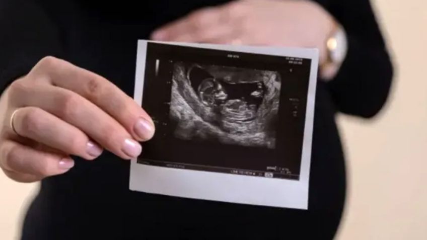¿Sonora despenalizó el aborto? Estos son los Estados de México donde ya es legal