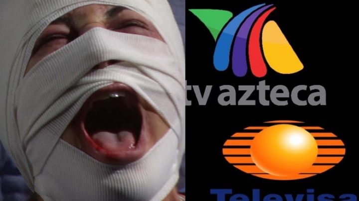Acabó desfigurada: Tras divorcio y retiro de novelas, exactriz de TV Azteca regresa a Televisa