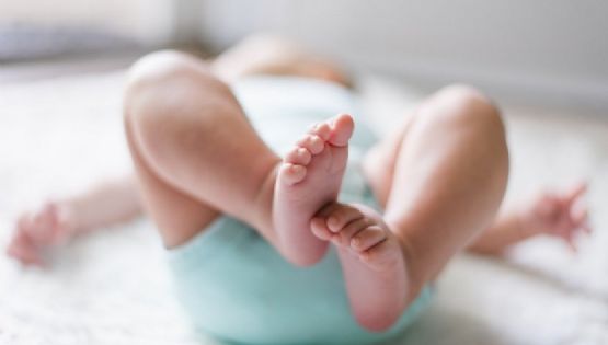Nace bebé con 2 caras, 4 brazos y 4 piernas: Una condición rara y triste