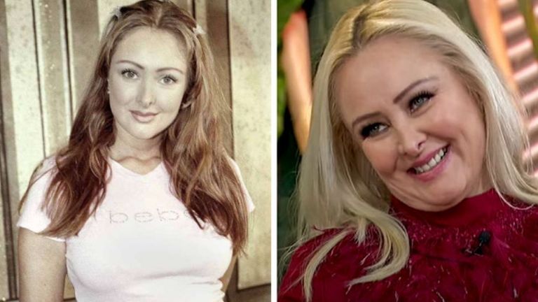 Antes y después de Marisol Santacruz