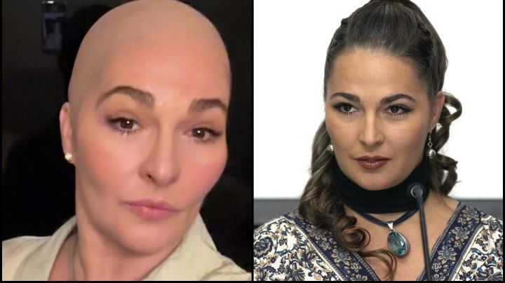Afamada actriz de Televisa reaparece sin cabello y alerta a sus miles de fans con estas FOTOS