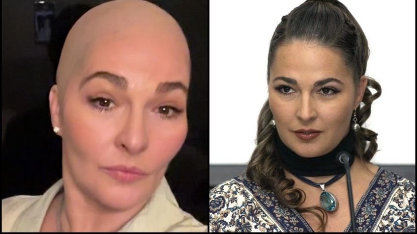 Afamada actriz de Televisa reaparece sin cabello y alerta a sus miles de fans con estas FOTOS