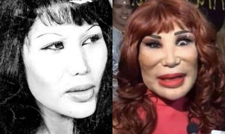 Antes y después de Lyn May