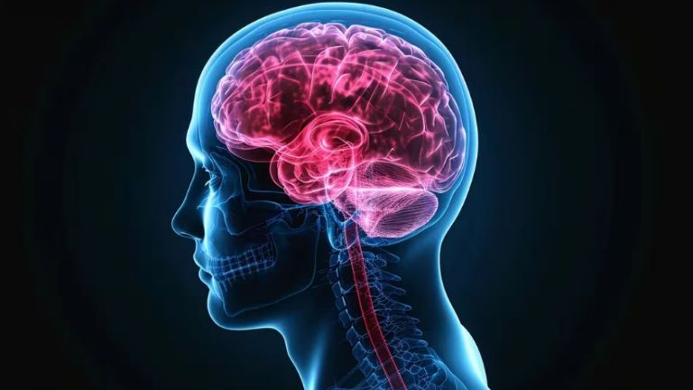 CHPV puede causar un rápido deterioro neurológico