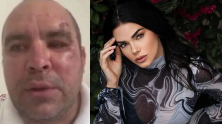 Abogada de Ernesto Zepeda da duro mensaje de su caso contra Livia Brito y confiesa esto