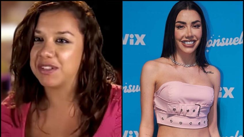 (FOTOS) 'La Casa de los Famosos México': Antes y después de las cirugías de Karime Pindter