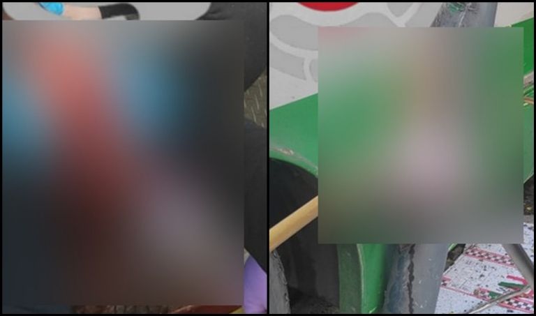 Pasajera pierde la pierna en accidente de Iztapalapa