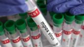 Foto ilustrativa de la nota titulada Viruela de mono en México: Refuerzan medidas contra Mpox en aeropuertos del Edomex