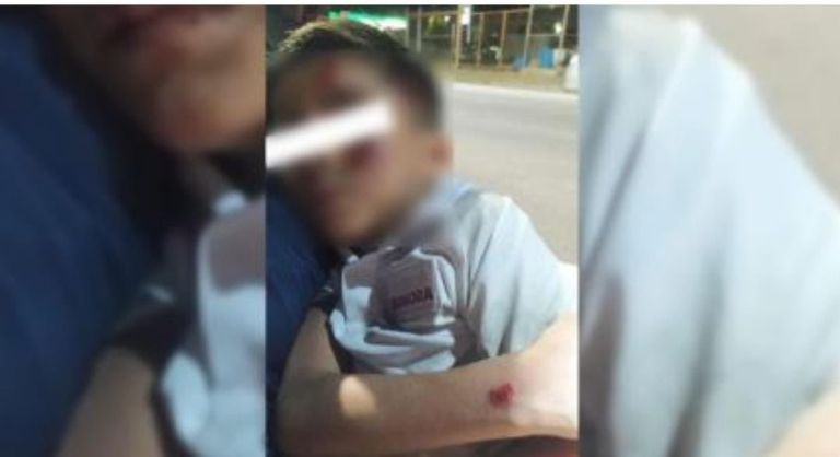 Se presenta responsable de atropellar niño en Hermosillo. Foto: Facebook