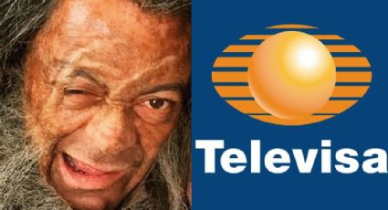 Acabó de indigente y desfigurado: Tras dejar TV Azteca, villano debuta en programa de Televisa