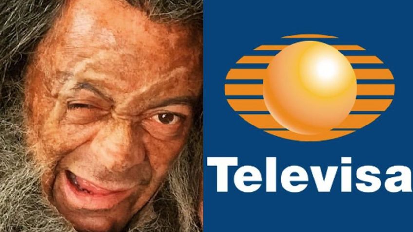 Acabó de indigente y desfigurado: Tras dejar TV Azteca, villano debuta en programa de Televisa