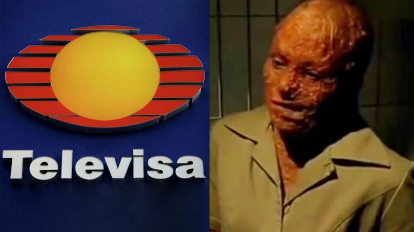 Acabó desfigurada: Tras 12 años retirada y un divorcio, protagonista de novelas vuelve a Televisa